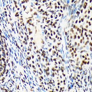 Immunohistochemistry analysis of paraffin-embedded rat ovary using Anti-ARID1A Antibody [ARC2177] (A308739) at a dilution of 1:100 (40X lens). Perform microwave antigen retrieval with 10 mM Tris/EDTA buffer pH 9.0 before commencing with IHC staining protocol