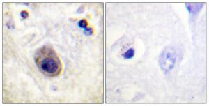 Immunohistochemical analysis of paraffin-embedded human brain using Anti-Connexin 43 (phospho Ser261) Antibody. The right hand panel represents a negative control, where the antibody was pre-incubated with the immunising peptide.