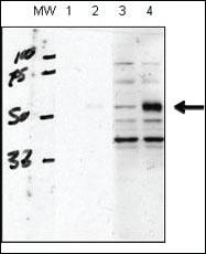 Anti-FUCA2 Mouse Monoclonal Antibody