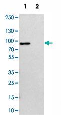 Anti-ACTN2 Rabbit Polyclonal Antibody