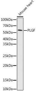 Anti-PLGF Rabbit Monoclonal Antibody [clone: ARC0749]