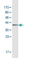 Anti-HTRA3 Mouse Monoclonal Antibody [clone: 1F2]