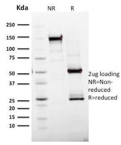 SDS-PAGE analysis of Anti-Ki67 Antibody [MKI67/2465] under non-reduced and reduced conditions; showing intact IgG and intact heavy and light chains, respectively SDS-PAGE analysis confirms the integrity and purity of the antibody