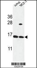 Anti-SPRR1A Rabbit Polyclonal Antibody