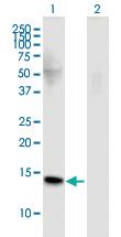 Anti-FMN2 Mouse Monoclonal Antibody [clone: 4B8]