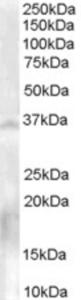 EB06680 (0.3 µg/ml) staining of Human Testis lysate (35 µg protein in RIPA buffer).  Primary incubation was 1 hour.  Detected by chemiluminescence.