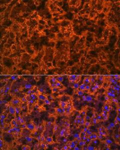 Anti-PLGF Rabbit Monoclonal Antibody [clone: ARC0749]