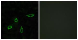 Immunofluorescence analysis of LOVO cells using Anti-EDG4 Antibody. The right hand panel represents a negative control, where the antibody was pre-incubated with the immunising peptide.