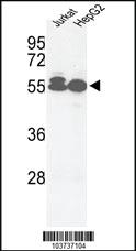 Anti-ACVRL1 Rabbit Polyclonal Antibody