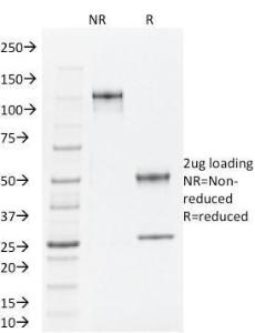 Anti-TLE1 Mouse Monoclonal Antibody [clone: TLE1/2062]