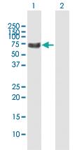 Anti-PRF1 Rabbit Polyclonal Antibody