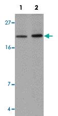 Anti-ANAPC10 Rabbit Polyclonal Antibody