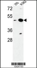 Anti-NUPL2 Rabbit Polyclonal Antibody