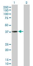 Anti-CTSL Rabbit Polyclonal Antibody