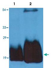 Anti-CD59 Mouse Monoclonal Antibody [clone: MEM-43/5]