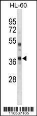 Anti-PBK Rabbit Polyclonal Antibody (HRP (Horseradish Peroxidase))