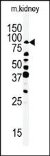 Anti-RIPK4 Rabbit Polyclonal Antibody