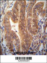 Anti-KIAA1644 Rabbit Polyclonal Antibody (PE (Phycoerythrin))