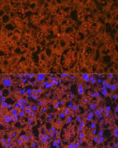 Anti-PLGF Rabbit Monoclonal Antibody [clone: ARC0749]