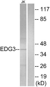 Anti-EDG3 antibody