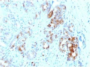 Anti-Ferritin Light Chain antibody