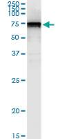 Anti-PRF1 Rabbit Polyclonal Antibody