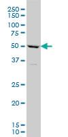 Anti-TBX6 Mouse Monoclonal Antibody [clone: 1D11]