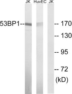 Anti-53BP1 Rabbit Polyclonal Antibody