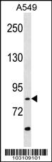 Anti-RIPK4 Rabbit Polyclonal Antibody