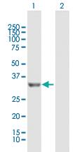 Anti-PROSC Mouse Polyclonal Antibody