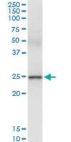 Anti-UBE2S Polyclonal Antibody Pair