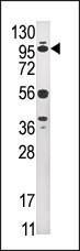 Anti-USP1 Rabbit Polyclonal Antibody (PE (Phycoerythrin))