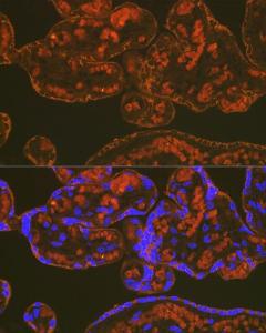 Anti-PLGF Rabbit Monoclonal Antibody [clone: ARC0749]