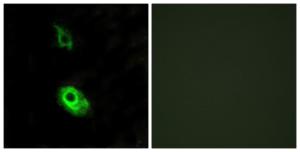 Anti-EDG3 antibody