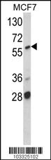 Anti-ARAF Rabbit Polyclonal Antibody