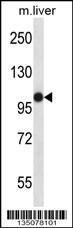 Anti-MASTL Rabbit Polyclonal Antibody (AP (Alkaline Phosphatase))