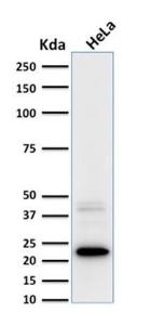 Anti-Ferritin Light Chain antibody