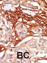 Anti-ARAF Rabbit Polyclonal Antibody