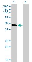 Anti-TNFRSF19 Mouse Monoclonal Antibody [clone: 2G4]