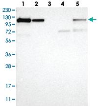 Anti-NFKB2 Rabbit Polyclonal Antibody