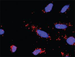 Anti-PIAS2 + CDKN2B Antibody Pair