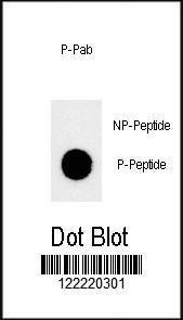 Anti-KDM3B Rabbit Polyclonal Antibody (AP (Alkaline Phosphatase))