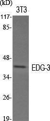 Anti-EDG3 antibody