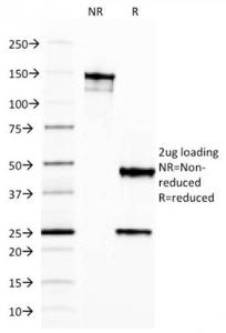 Anti-Ferritin Light Chain antibody