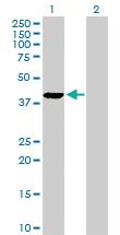 Anti-JMJD7-PLA2G4B Rabbit Polyclonal Antibody