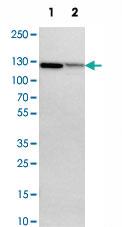 Anti-NFKB2 Rabbit Polyclonal Antibody