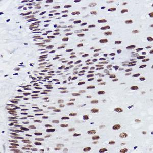 Immunohistochemistry analysis of paraffin-embedded human esophageal using Anti-BRMS1 Antibody [ARC2536] (A307654) at a dilution of 1:100 (40x lens)