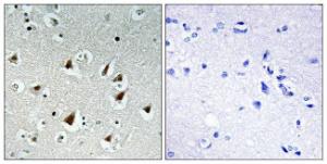 Immunohistochemical analysis of paraffin-embedded human brain tissue using Anti-ZHX2 Antibody. The right hand panel represents a negative control, where the antibody was pre-incubated with the immunising peptide