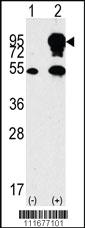 Anti-BRAF Rabbit Polyclonal Antibody