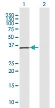 Anti-CTSS Rabbit Polyclonal Antibody